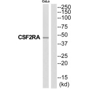 Colony Stimulating Factor 2 Receptor Alpha (CSF2RA) Antibody