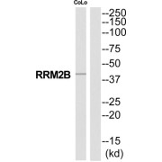 Ribonucleoside-Diphosphate Reductase Subunit M2 B (RRM2B) Antibody