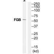 Fibrinogen Beta (FGB) Antibody