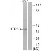 Western blot analysis of extracts from COLO cells, using HTR5B antibody. The lane on the right is blocked with the synthesised peptide.