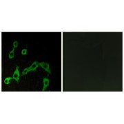 Immunofluorescence analysis of LOVO cells, using ADRA2A antibody.