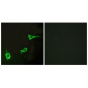 Immunofluorescence analysis of LOVO cells, using ADRA1B antibody.