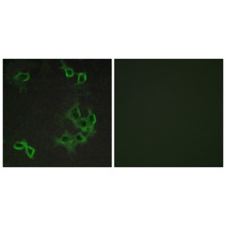 Atypical Chemokine Receptor 4 (ACKR4) Antibody