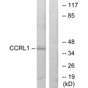 Western blot analysis of extracts from 293 cells, using CCRL1 antibody.