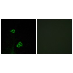 Chemokine C-X-C-Motif Receptor 7 (CXCR7) Antibody