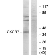 Western blot analysis of extracts from COS-7 cells, using CXCR7 antibody.