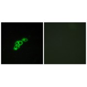 Immunofluorescence analysis of MCF-7 cells, using FSHR antibody.