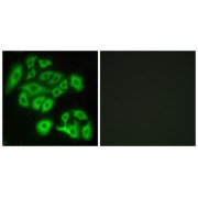 Immunofluorescence analysis of A549 cells, using FZD4 antibody.