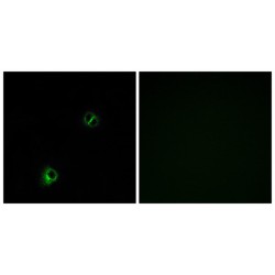 Frizzled Homolog 9 (FZD9) Antibody