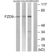 Western blot analysis of extracts from HUVEC cells COLO cells and COS cells, using FZD9 antibody.