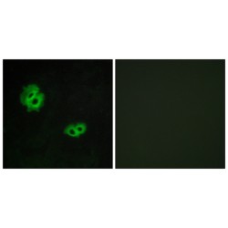 Probable G-Protein Coupled Receptor 171 (GPR171) Antibody