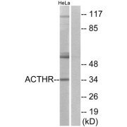 Western blot analysis of extracts from HeLa cells, using ACTHR antibody.