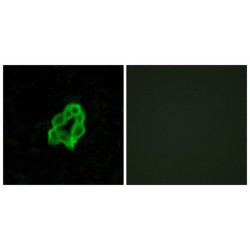 Brain Specific Angiogenesis Inhibitor 1 / BAI1 (ADGRB1) Antibody