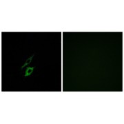 Immunofluorescence analysis of A549 cells, using FPR1 antibody.