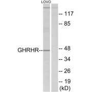 Western blot analysis of extracts from LOVO cells, using GHRHR antibody.