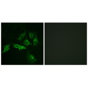 Immunofluorescence analysis of A549 cells, using GNRHR antibody.