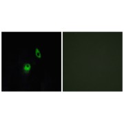 Immunofluorescence analysis of HeLa cells, using GPR124 antibody.