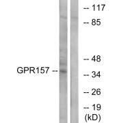 Western blot analysis of extracts from NIH-3T3 cells, using GPR157 antibody.