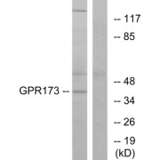 Western blot analysis of extracts from K562 cells, using GPR173 antibody.