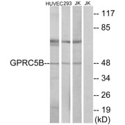 Western blot analysis of extracts from HUVEC cells, 293cells and Jurkat cells, using GPRC5B antibody.