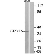 Western blot analysis of extracts from LOVO cells, using GPR17 antibody.