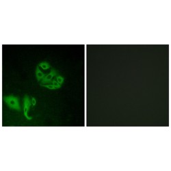 G-Protein Coupled Receptor 20 (GPR20) Antibody