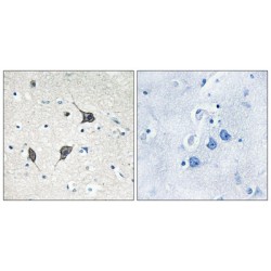 G-Protein Coupled Receptor 20 (GPR20) Antibody