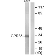 Western blot analysis of extracts from LOVO cells, using GPR35 antibody.