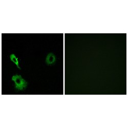 Glutamate Metabotropic Receptor 7 (GRM7) Antibody