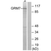 Western blot analysis of extracts from Jurkat cells, using GRM7 antibody. The lane on the right is blocked with the synthesized peptide.