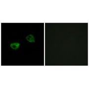 Immunofluorescence analysis of HepG2 cells, using MTR1A antibody.