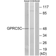 Western blot analysis of extracts from RAW264.7 cells and COS-7 cells, using GPRC5C antibody.