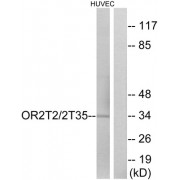 Western blot analysis of extracts from HUVEC cells, using OR2T2/2T35 antibody.