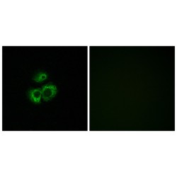 Olfactory Receptor Family 52 Subfamily D Member 1 (OR52D1) Antibody