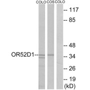 Western blot analysis of extracts from COLO cells and COS cells, using OR52D1 antibody.