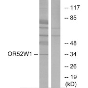 Western blot analysis of extracts from HeLa cells, using OR52W1 antibody.