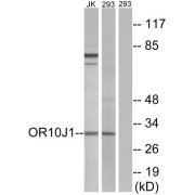 Western blot analysis of extracts from Jurkat cells and 293 cells, using OR10J1 antibody.