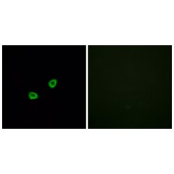 Olfactory Receptor Family 1 Subfamily L Member 6 (OR1L6) Antibody