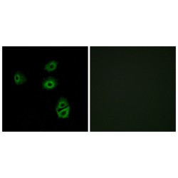 Olfactory Receptor Family 2 Subfamily B Member 2 (OR2B2) Antibody