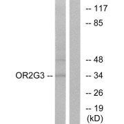 Western blot analysis of extracts from Jurkat cells, using OR2G3 antibody.