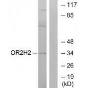 Western blot analysis of extracts from MCF-7 cells, using OR2H2 antibody.