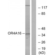 Western blot analysis of extracts from COLO cells, using OR4A16 antibody.