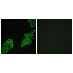 Olfactory Receptor Family 4 Subfamily C Member 3 (OR4C3) Antibody