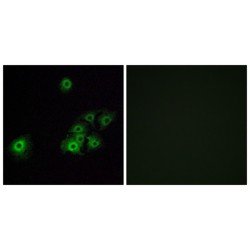 Olfactory Receptor Family 4 Subfamily C Member 15 (OR4C15) Antibody