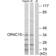 Western blot analysis of extracts from HepG2 cells and Jurkat cells, using OR4C15 antibody.