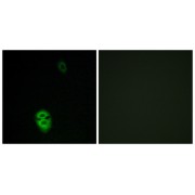 Immunofluorescence analysis of Jurkat cells, using OR4K17 antibody.