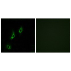 Olfactory Receptor Family 4 Subfamily L Member 1 (OR4L1) Antibody