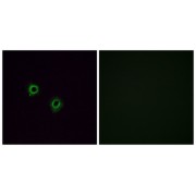 Immunofluorescence analysis of A549 cells, using OR2J3 antibody. The picture on the right is blocked with the synthesized peptide.