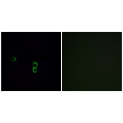 Olfactory Receptor Family 9 Subfamily Q Member 1 (OR9Q1) Antibody