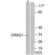 Western blot analysis of extracts from Jurkat cells, using OR9Q1 antibody.